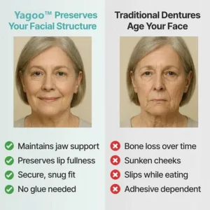 💗Ends Today: 70% OFF! Custom Custom-Fit Full Functional DenturesMake you more confident - Image 7