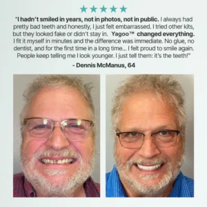 💗Ends Today: 70% OFF! Custom Custom-Fit Full Functional DenturesMake you more confident - Image 9