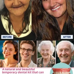 🎁🌎Ends Today: 70% OFF! Medical Full Denture with Strong Suction^ 🏆 2026 Best Seller - Image 5
