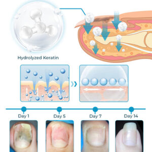 Bee Venom Nail Fungus Treatment Elixir - Image 5