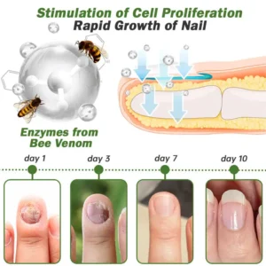 Nail Fungus Treatment Serum - Image 11