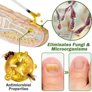 Nail Fungus Treatment Serum - Image 9