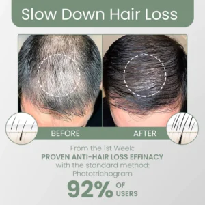 FolliclePLUS Haarwachstumstropfen - Image 4