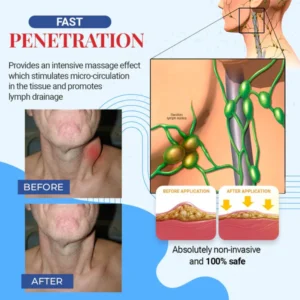 Fivfivgo Thyroid Gland Lymph Nodes Patches - Image 3