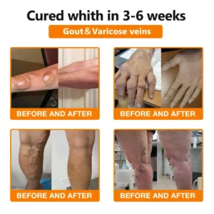 Bee Venom & Turmeric Joint and Bone Pain Relief Cream - Image 5