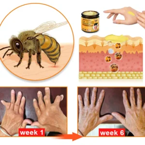 Bee Venom & Turmeric Joint and Bone Pain Relief Cream - Image 7