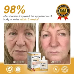 Botox Bee Venom Wrinkle - Image 14