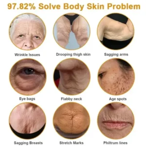 Botox Bee Venom Wrinkle - Image 4