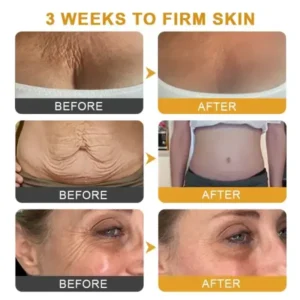 Botox Bee Venom Wrinkle - Image 8
