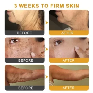 Botox Bee Venom Wrinkle - Image 9