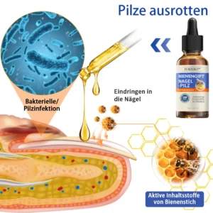 Bee Venom Nail Fungus Treatment Solution - Image 3
