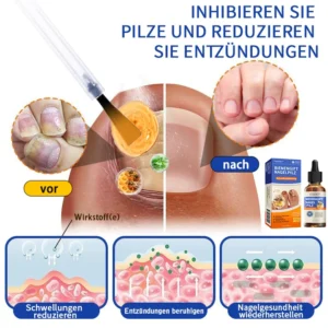 Bee Venom Nail Fungus Treatment Solution - Image 5