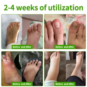 FungiVanish Foot Treatment Spray - Image 2