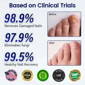 Anti-Fungal Nail Repair Patch - Image 2
