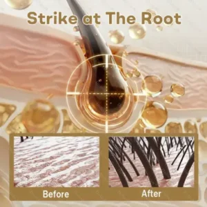 Hair Regrowth Capsules Nano Penetration, Deep into Hair Roots - Image 6