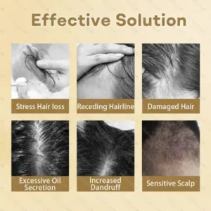 Hair Regrowth Capsules Newly Upgraded,Nano Penetration, Deep into Hair Roots - Image 3