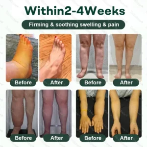 LymphDrain Herbal Soothing Cream - Image 2