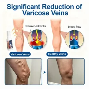 Nano-Liposomal Vascular Intervention (FDA-Registered Molecular Repair) - Image 4