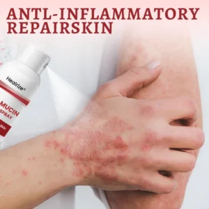 Snail Mucin Healing Spray – Relief for Sensitive & Flare-Up Skin - Image 9