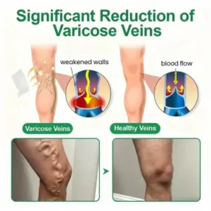 VeinEase Microneedle Care PatchInstant Relief, Long-Term Results - Image 3