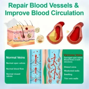 VeinEase Microneedle Care PatchInstant Relief, Long-Term Results - Image 7