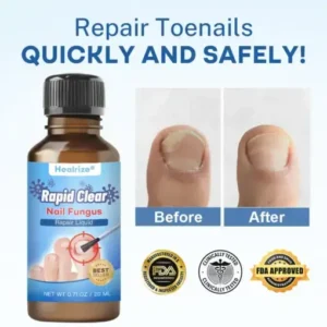 Nano Rapid Clear Nail Fungus Rapair Liquid Effective in 7 Days, Permanently Eliminates the Root - Image 2