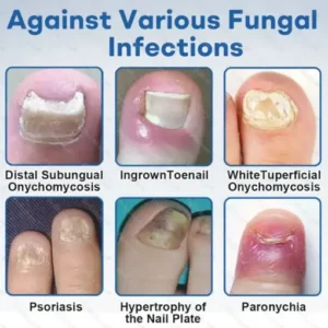 Nano Rapid Clear Nail Fungus Rapair Liquid Effective in 7 Days, Permanently Eliminates the Root - Image 8