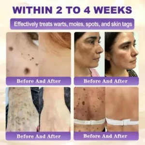 Biotin 10-in-1 Skin Restoration Cream - Image 11
