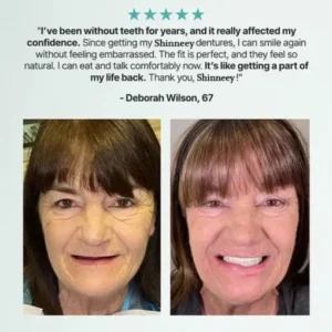 Custom Fit for a Fresh Smile, Say Goodbye to Wearing Discomfort! - Image 12