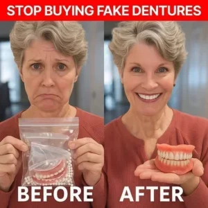 Custom-Fit Functional Dentures - Image 2