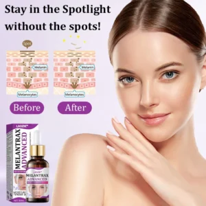 MelantraX Advanced Anti-Hyperpigmentation Essence - Image 2