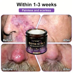 🔥LAST DAY 50% OFF Biotin 10-in-1 Skin Restoration Cream - Image 8