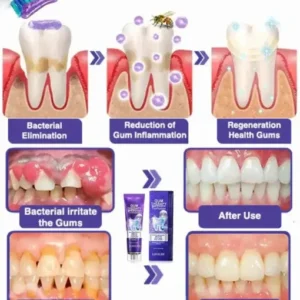 Bee Poison Dental Treatment Toothpaste - Image 6