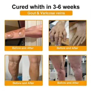 Bee Poison Pain-Relief Bone Healing Cream - Image 5