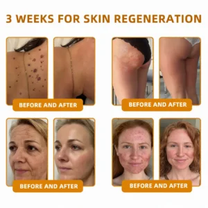 Bee Poison Skin Restoration Cream - Image 17