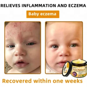 🐝Bee Poison Skin Restoration Cream 🐝 - Image 8