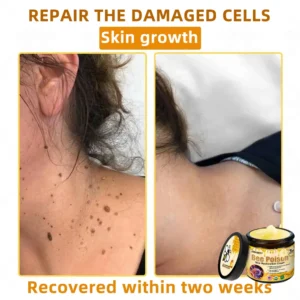 🐝Bee Poison Skin Restoration Cream 🐝 - Image 9