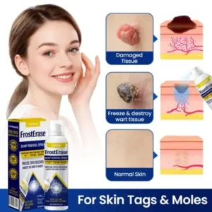 FrostErase Bump Renewal Spray - Image 6