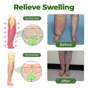 𝑶𝒇𝒇𝒊𝒄𝒊𝒂𝒍 𝑺𝒕𝒐𝒓𝒆 Professional Leg Circulation Cream - Image 4