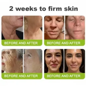 moringa Vita-A Retinol Shot Wrinkle-Lift Tightening cream – Last Day Promotion 50 OFF - Image 7