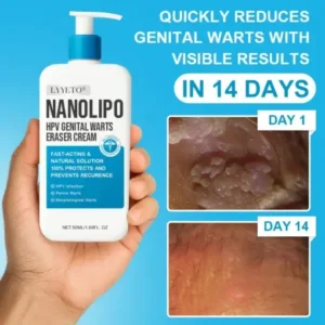 NANOLIPO HPV GENITAL WARTS ERASER CREAM - Image 2