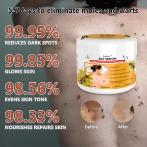 Bee Venom Mole and Wart Treatment Cream - Image 4