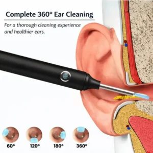 Limited Time 70% Intelligent Waterproof Visual Earwax Remover - Image 5