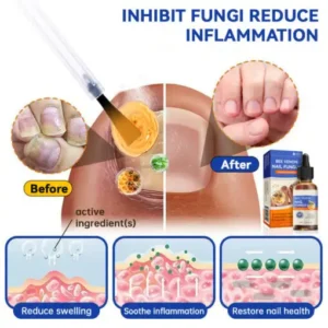 Bee Venom Nail Fungus Treatment Solution - Image 2