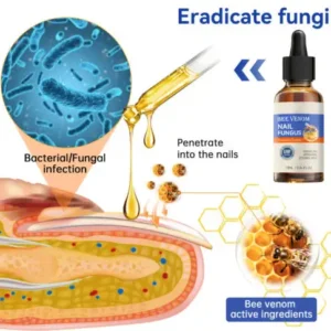 Bee Venom Nail Fungus Treatment Solution - Image 5