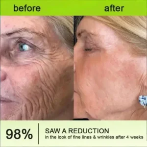 Botin Vita-A Retinol Shot Wrinkle-Lift Tightening cream – Last Day Promotion 70 OFF - Image 10