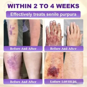 Made and Shipped from UK Biotin 10-in-1 Skin Restoration Cream - Image 6