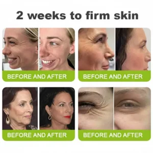 🧠👨‍⚕️Made and shipped from the USA moringa & Vita-A Retinol Shot Wrinkle-Lift Tightening cream - Last Day Promotion 50% OFF - Image 6