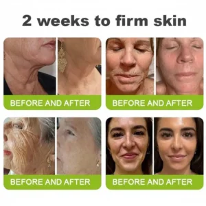 🧠👨‍⚕️Made and shipped from the USA moringa & Vita-A Retinol Shot Wrinkle-Lift Tightening cream - Last Day Promotion 50% OFF - Image 7