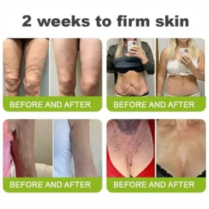 🧠👨‍⚕️Made and shipped from the USA moringa & Vita-A Retinol Shot Wrinkle-Lift Tightening cream - Last Day Promotion 50% OFF - Image 8